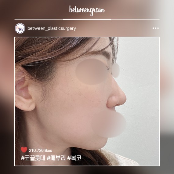 비…