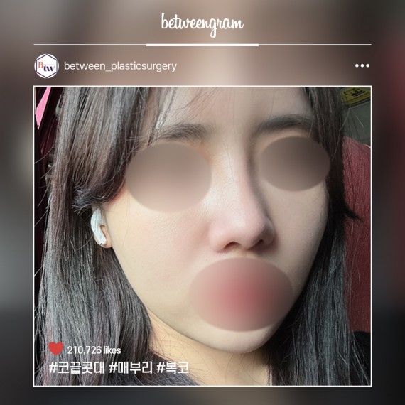 비…