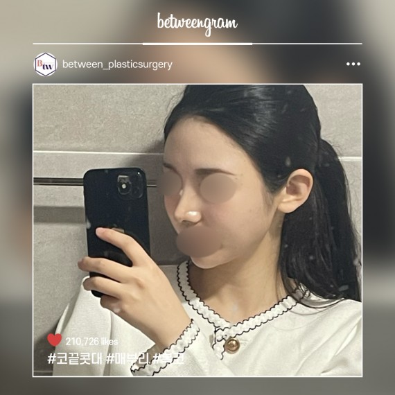 비…