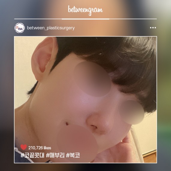 비…
