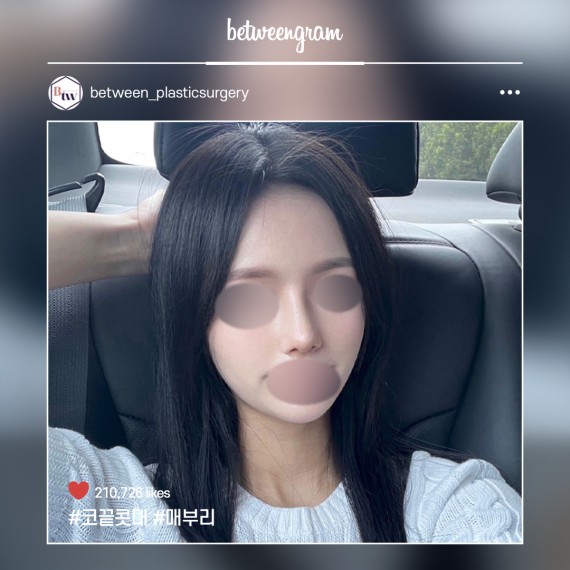 비…