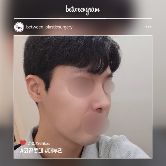 비…