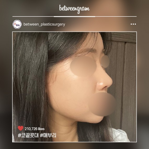 비…