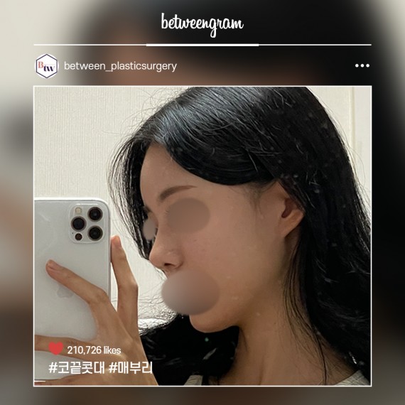 비…