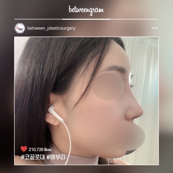 비…