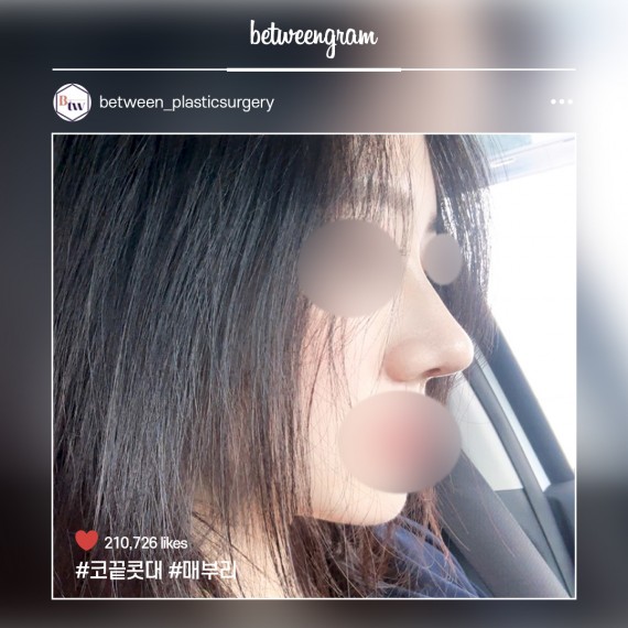 비…
