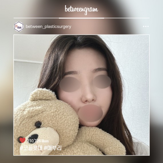 비…