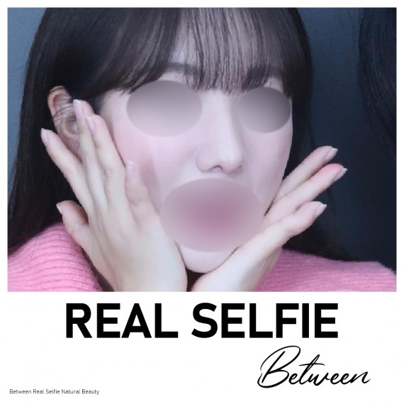 비…