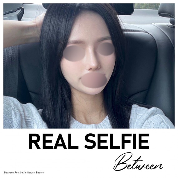 비…