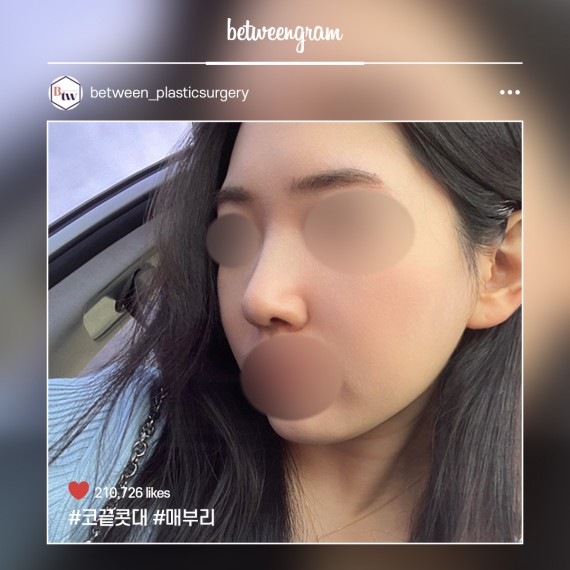 비…