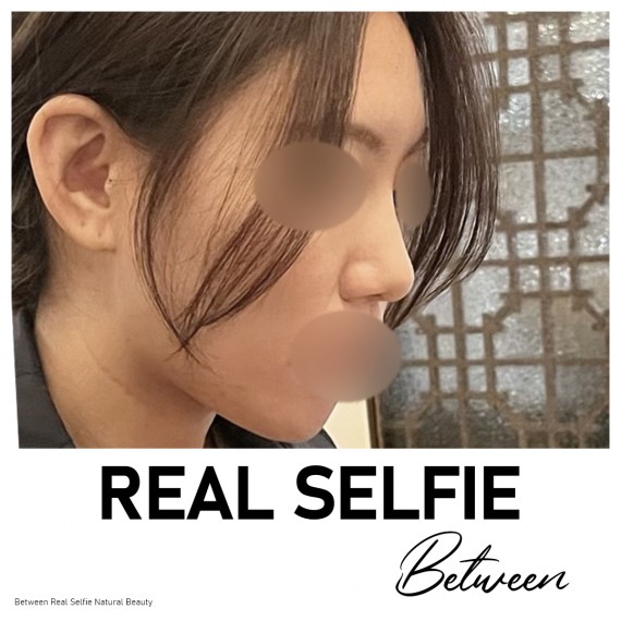 비…