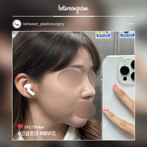 비…