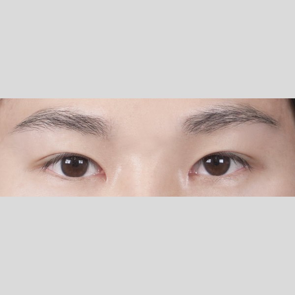 자연유착