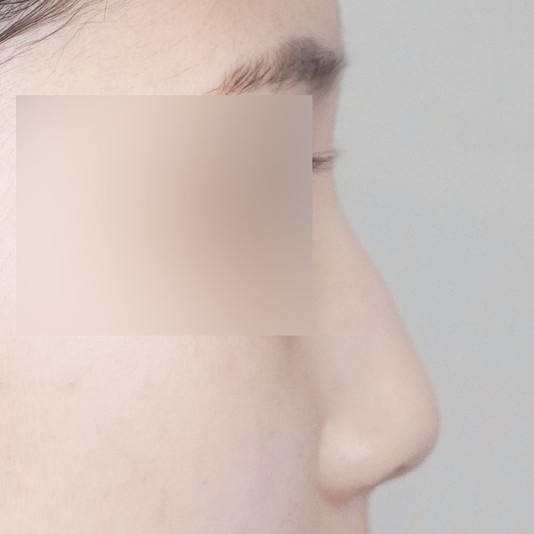 코…